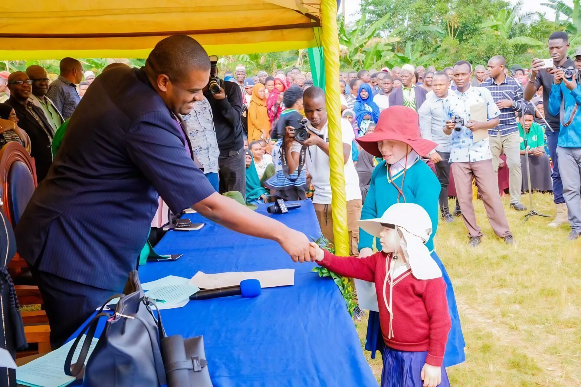 people with albinism